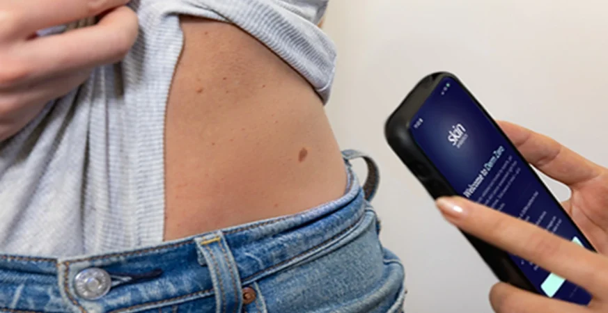 New AI-Powered App Enables Skin Cancer Assessment in Seconds New AI-Powered App Enables Skin Cancer Assessment in Seconds