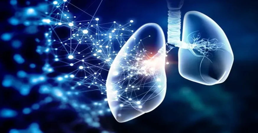 SpliSense Secures $13m Funding to Progress Novel Cystic Fibrosis Therapy SpliSense Secures $13m Funding to Progress Novel Cystic Fibrosis Therapy
