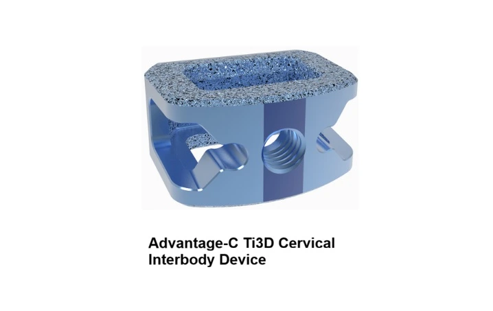 Intelivation Marks First Clinical Implantation of 3D-Printed Cervical Fusion Device Intelivation Marks First Clinical Implantation of 3D-Printed Cervical Fusion Device