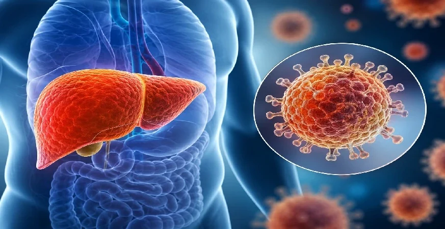 How India Is Combating Hepatitis