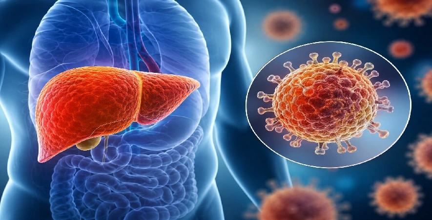 How India Is Combating Hepatitis
