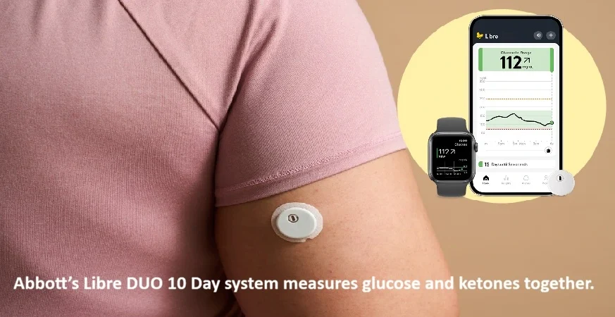 Abbott’s Libre Duo 10 Day Gets FDA Authorization for Continuous Glucose