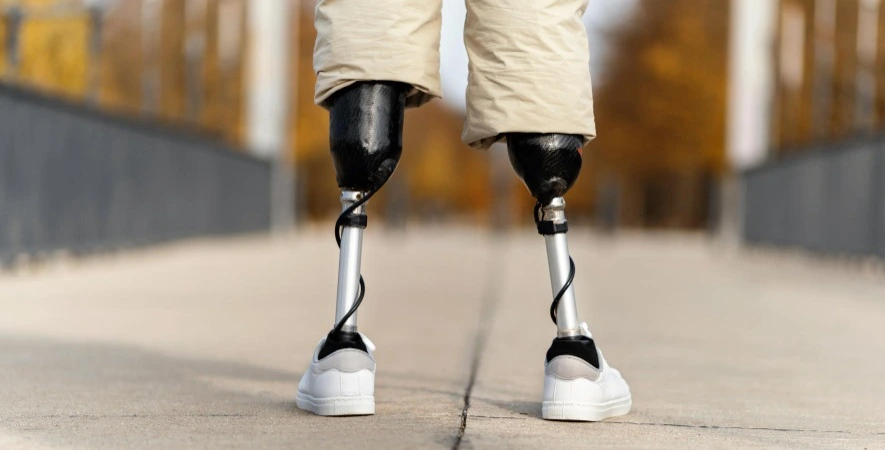 India’s Prosthetics Sector Eyes Indigenous Manufacturing, Wider Access
