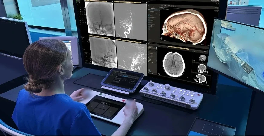 Philips Selected for ARPA-H Programme to Advance AI-Enabled Robotic Stroke Care