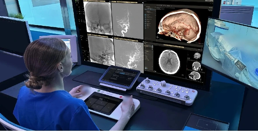 Philips Selected for ARPA-H Programme to Advance AI-Enabled Robotic Stroke Care