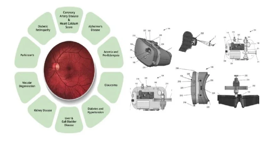 Remidio Wins US Patent for Wearable Eye Imaging Technology Remidio Wins US Patent for Wearable Eye Imaging Technology Remidio Combines Multiple Eye Examinations into a Single Wearable Device