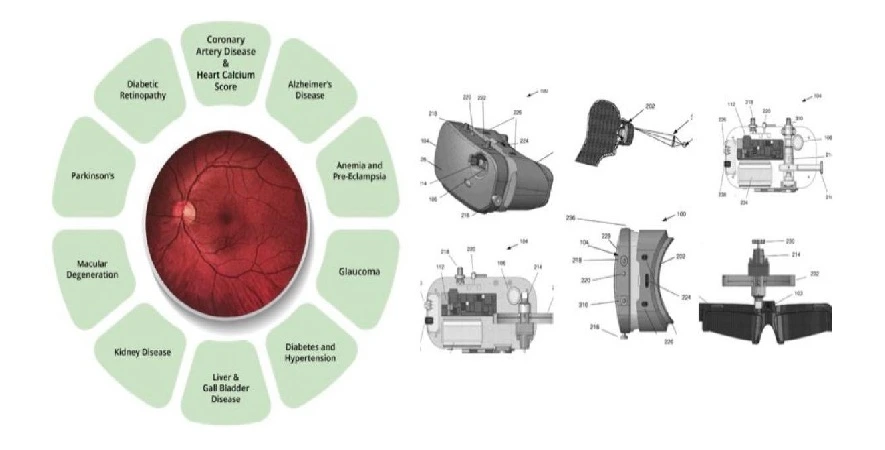 Remidio Combines Multiple Eye Examinations into a Single Wearable Device