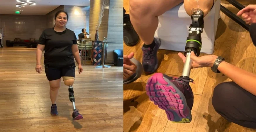 Insurance Coverage for Prostheses Can Empower Amputees, Boost the Economy Insurance Coverage for Prostheses Can Empower Amputees, Boost the Economy Patients, Industry Leaders Urge Insurance Coverage for Prosthetic Limbs