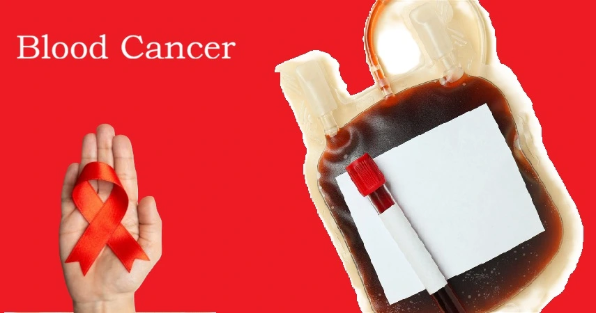 Blood Cancer Treatment Advances Save Nearly 26 Million Life-Years in US Over 75 Years